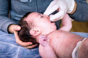 Tratamiento craneal para bebés